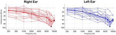 Impact of a combination sound therapy on tinnitus distress: an exploratory one-year longitudinal study